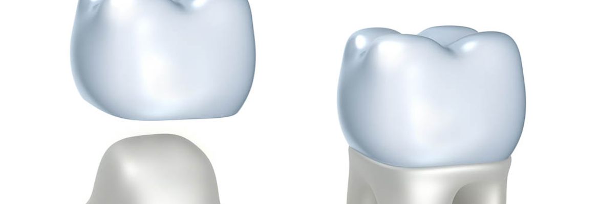 crowns made in costa rica