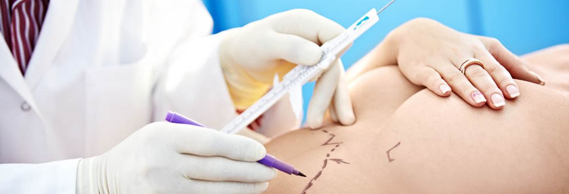 cosmetic surgery in costa rica